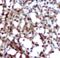 CD79a antibody, MBS551050, MyBioSource, Immunohistochemistry paraffin image 