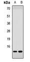 NADH:Ubiquinone Oxidoreductase Subunit S6 antibody, LS-C668598, Lifespan Biosciences, Western Blot image 