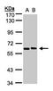 5'-Nucleotidase, Cytosolic II antibody, LS-C185730, Lifespan Biosciences, Western Blot image 
