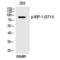 Aconitase 1 antibody, PA5-40262, Invitrogen Antibodies, Western Blot image 