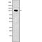 ADAM Metallopeptidase Domain 19 antibody, abx147978, Abbexa, Western Blot image 