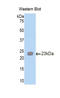 Angiopoietin Like 2 antibody, LS-C421284, Lifespan Biosciences, Western Blot image 