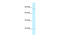 Bromodomain Containing 2 antibody, 28-034, ProSci, Western Blot image 