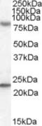 DExH-Box Helicase 58 antibody, LS-C87220, Lifespan Biosciences, Western Blot image 