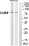 NIMA Related Kinase 5 antibody, abx014856, Abbexa, Western Blot image 