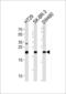 Heart And Neural Crest Derivatives Expressed 1 antibody, 57-713, ProSci, Western Blot image 