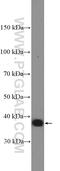NFKB Inhibitor Alpha antibody, 10268-1-AP, Proteintech Group, Western Blot image 