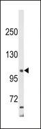 Adaptor Related Protein Complex 2 Subunit Alpha 2 antibody, LS-C156387, Lifespan Biosciences, Western Blot image 