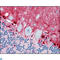 S100 Calcium Binding Protein A1 antibody, LS-C814074, Lifespan Biosciences, Immunohistochemistry paraffin image 