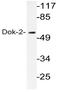 Docking Protein 2 antibody, AP20563PU-N, Origene, Western Blot image 