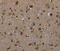 GLI Pathogenesis Related 1 antibody, MBS2520746, MyBioSource, Immunohistochemistry frozen image 