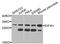 Eukaryotic Translation Initiation Factor 4H antibody, STJ111994, St John