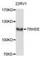 Thyrotropin Releasing Hormone Degrading Enzyme antibody, abx126736, Abbexa, Western Blot image 