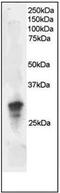 Growth Factor Receptor Bound Protein 2 antibody, orb89281, Biorbyt, Western Blot image 