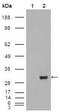 Carbonic Anhydrase 1 antibody, AM06244SU-N, Origene, Western Blot image 