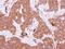 Fyn Related Src Family Tyrosine Kinase antibody, PA5-28573, Invitrogen Antibodies, Immunohistochemistry paraffin image 