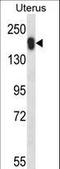 UBP43 antibody, LS-B14531, Lifespan Biosciences, Western Blot image 