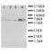 Receptor Interacting Serine/Threonine Kinase 2 antibody, LS-C313001, Lifespan Biosciences, Western Blot image 