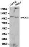 Phosphatidylinositol-4,5-Bisphosphate 3-Kinase Catalytic Subunit Gamma antibody, LS-C192625, Lifespan Biosciences, Western Blot image 