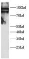 TGF-Beta Activated Kinase 1 (MAP3K7) Binding Protein 3 antibody, FNab10439, FineTest, Western Blot image 