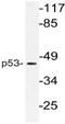 p53 antibody, AP21105PU-N, Origene, Western Blot image 