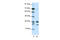 Cyclin Dependent Kinase 5 antibody, 28-886, ProSci, Western Blot image 