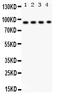 Dipeptidyl Peptidase 4 antibody, PB9580, Boster Biological Technology, Western Blot image 