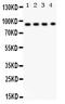 Dipeptidyl peptidase IV antibody, PB9580, Boster Biological Technology, Western Blot image 