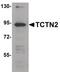 Tectonic-2 antibody, PA5-20984, Invitrogen Antibodies, Western Blot image 