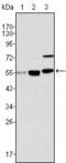 Lysine Acetyltransferase 8 antibody, MA5-15345, Invitrogen Antibodies, Western Blot image 