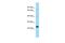 Mediator Complex Subunit 20 antibody, A09407, Boster Biological Technology, Western Blot image 