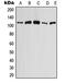 Anion exchange protein 4 antibody, GTX55974, GeneTex, Western Blot image 