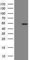 Keratin 23 antibody, M12673, Boster Biological Technology, Western Blot image 