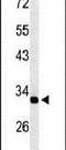 Transmembrane And Ubiquitin Like Domain Containing 2 antibody, PA5-26646, Invitrogen Antibodies, Western Blot image 