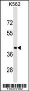 Poly(RC) Binding Protein 1 antibody, 60-150, ProSci, Western Blot image 