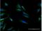 Calcitonin Related Polypeptide Beta antibody, H00000797-B02P-50ug, Novus Biologicals, Immunofluorescence image 
