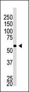 Beta-Secretase 2 antibody, PA5-13103, Invitrogen Antibodies, Western Blot image 