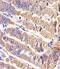 Receptor Tyrosine Kinase Like Orphan Receptor 2 antibody, PA5-72192, Invitrogen Antibodies, Immunohistochemistry frozen image 