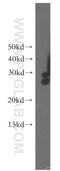 Dehydrogenase/Reductase 2 antibody, 15735-1-AP, Proteintech Group, Western Blot image 