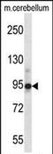 Chordin antibody, PA5-71934, Invitrogen Antibodies, Western Blot image 