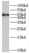 Protein Phosphatase 4 Regulatory Subunit 3B antibody, FNab08024, FineTest, Western Blot image 