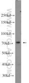 Pre-MRNA Processing Factor 39 antibody, 24480-1-AP, Proteintech Group, Western Blot image 