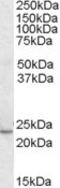 Kruppel Like Factor 16 antibody, STJ70189, St John