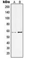 Potassium Voltage-Gated Channel Subfamily C Member 1 antibody, orb214151, Biorbyt, Western Blot image 