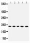 Interleukin 2 antibody, LS-C313407, Lifespan Biosciences, Western Blot image 