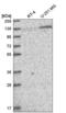 Pumilio RNA Binding Family Member 2 antibody, NBP2-56823, Novus Biologicals, Western Blot image 