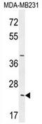 Synaptonemal Complex Central Element Protein 2 antibody, AP54118PU-N, Origene, Western Blot image 