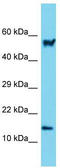 Actin Related Protein 2/3 Complex Subunit 5 antibody, TA337971, Origene, Western Blot image 