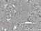 Centromere Protein E antibody, 28142-1-AP, Proteintech Group, Immunohistochemistry paraffin image 