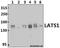 Large Tumor Suppressor Kinase 1 antibody, GTX66748, GeneTex, Western Blot image 